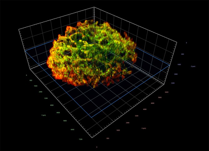This image shows a bone scaffold seeded with tumor cells.