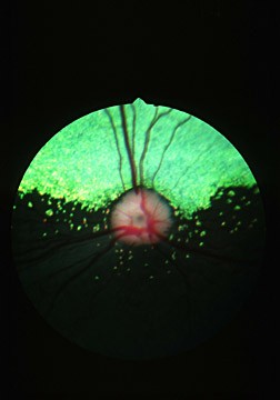  retinal fundus photograph of a Briard dog with the inherited eye disease
