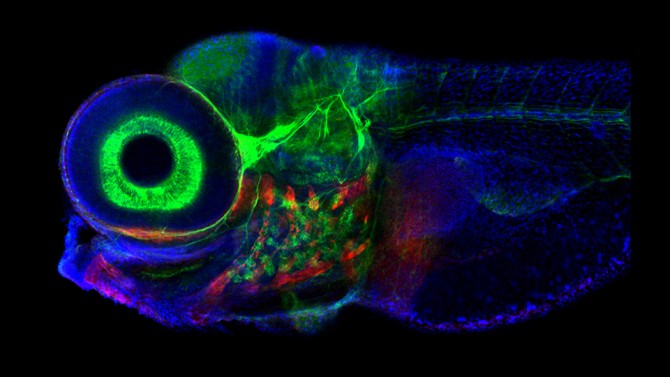 Zebrafish, photographed with confocal microscope. The brain region that controls eye movement is structurally similar in fish and mammals, but the zebrafish system contains only 500 neurons, making it a good model organism.
