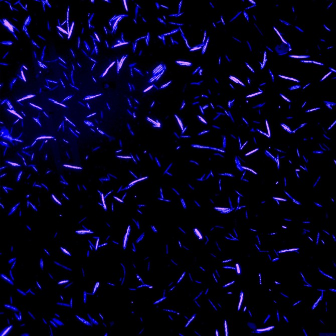 microscope image shows gut microbes